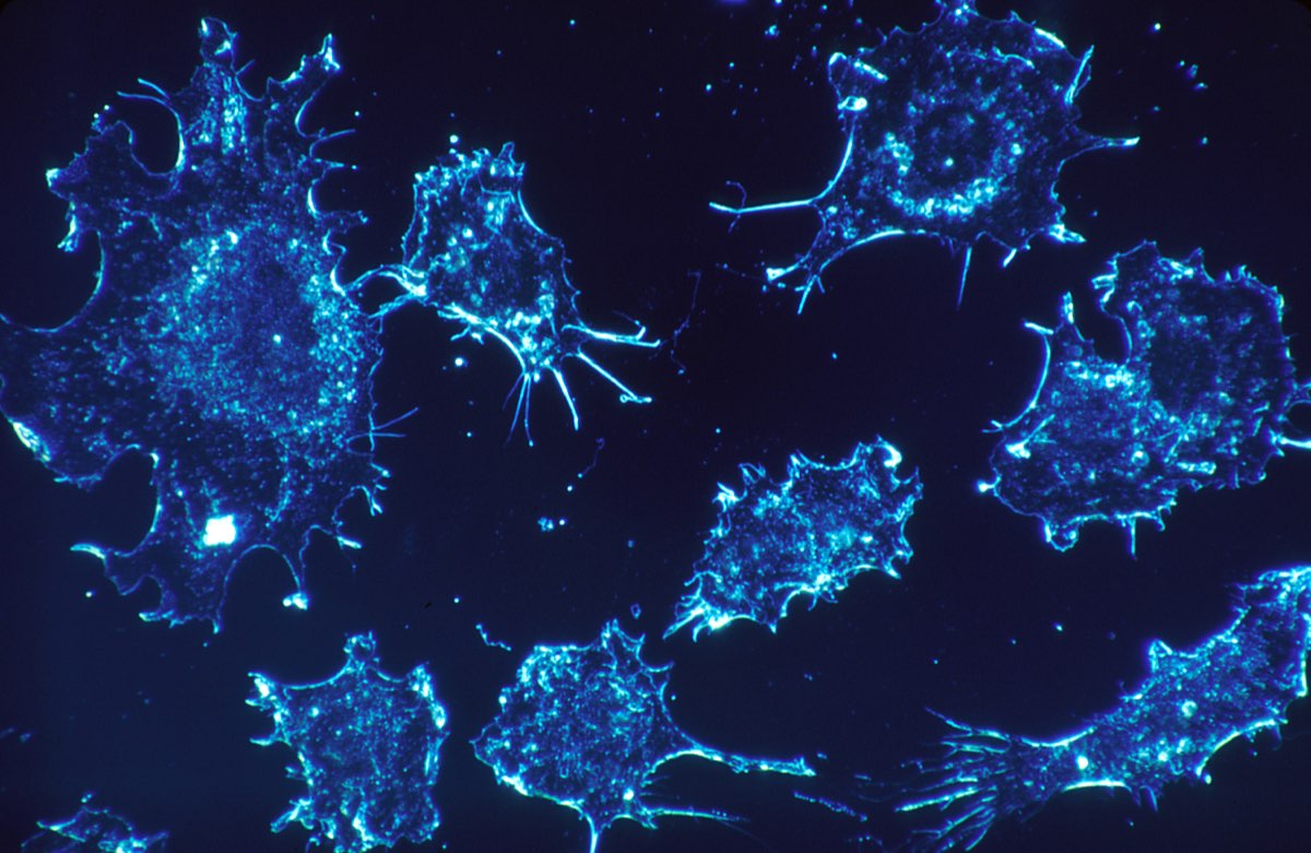 Platinum-Resistant Ovarian Cancer: Symptoms, Causes and Treatment