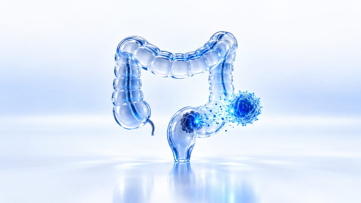FDA Approves Jemperli for dMMR Locally Advanced Rectal Cancer